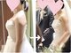 ソウ バイ ソウ(So by 蒼)の写真/≪肩幅矯正－3cm≫日本唯一の専門術で、ドレスが似合う華奢な肩&背中へ。整った肋骨/肩甲骨/細二の腕/美乳