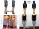 練馬アカデミア美容整体院の写真/痩せない理由は骨盤/姿勢の崩れが原因?練馬の老舗整体院が提供"美容姿勢"習得で痩身ダイエットは可能です♪