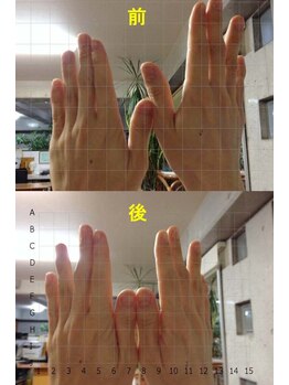 アトラス ストレートカイロプラクティック/手の長さのチェック