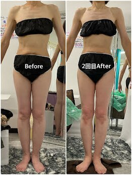 輝 らいと/ビフォーアフター(正面)