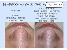 ビオルブ(VIOLVE)/毛穴洗浄/ハーブピーリング/徳島