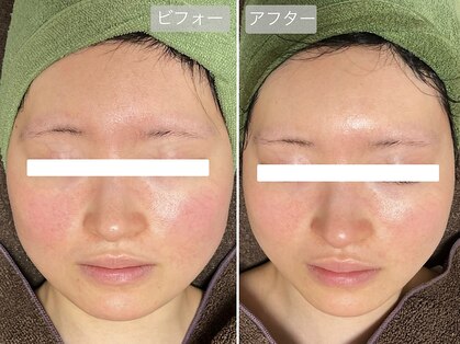 スローガーデン(Slow Garden)の写真