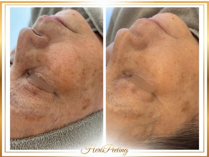 ロージー(ROSY)の写真