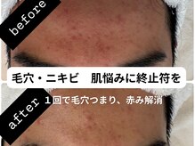 リベレ(Libelle)の雰囲気（どんなお悩みにも対応★気軽にご相談下さい♪）
