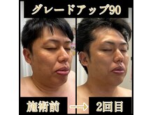 リリーローズ(LilyRose)の雰囲気（「なんか顔が違う」「若い！」鏡を見たお客様の第一声です。）