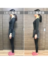 シェア 人形町店(Chare)/【小顔・骨盤矯正・О脚・整体】