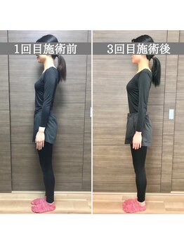 シェア 人形町店(Chare)/【小顔・骨盤矯正・О脚・整体】