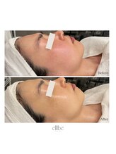 エルベ(ellbe)/リアボーテタラソトリートメント