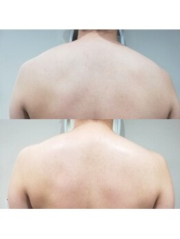 RiとBiのたまご/（ブライダル）体験コース