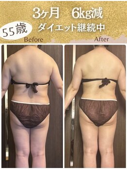 アーユルヴェーダアンドアロマエステ アユス(AYUS)/ダイエット3ヶ月