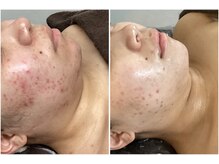 アイズ 横浜店(ize)/