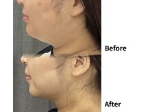 【痩身】個室/カウンセリングからリラックスして受けて頂けます