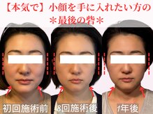 フレキシボディ(FlexiBody)