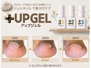 ★大好評★【巻き爪ケア】UP GEL