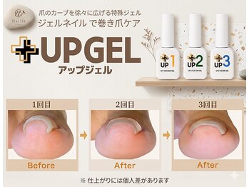 ★大好評★【巻き爪ケア】UP GEL