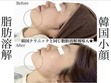 エステティック リベル キョウト 京都駅前店(Esthetic Liber Kyoto)/韓国小顔コルギ×脂肪分解