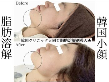 エステティック リベル キョウト 京都駅前店(Esthetic Liber Kyoto)/韓国小顔コルギ×脂肪分解
