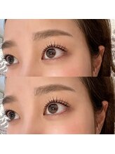 プロケア リッシュ(Procare Riche)/