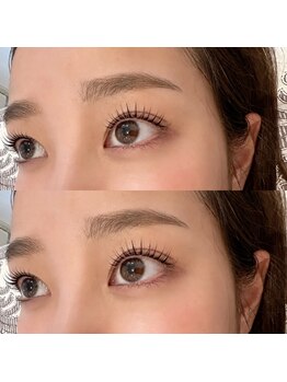 プロケア リッシュ(Procare Riche)/