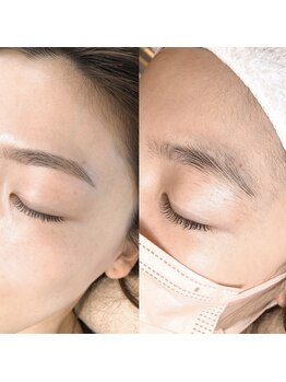 メメビューティー アンド ワキシング(meme beauty&waxing)/お顔の産毛ケア