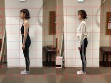 キラリ(KIRARI)/猫背改善