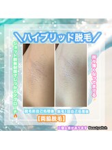 ビューティ ウィッチ(Beauty Witch)/