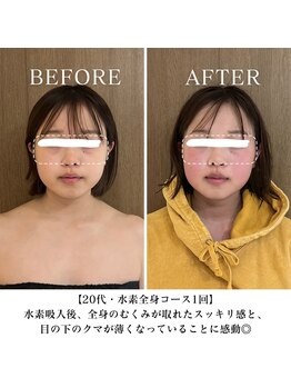 ヨサパーク リバティ 池袋東口店(YOSA PARK Liberty)/Before＆After