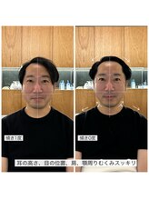 シャウルデッサン(CHARLESDESSIN)/骨格補正スパ