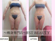 エストビューティー 池袋店(EST BEAUTY)