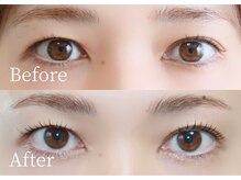 シャルリス(CHALELISS)/左右差があって片方押される