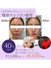【小顔×肌管理】小顔&たるみケア二重顎ほうれい線毛穴美肌ケア60分¥11,000→