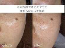コモレビ(komorebi)の雰囲気（【相模大野】フェイスワックスで毛穴・くすみ改善）