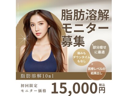アグテ(Agte)の写真