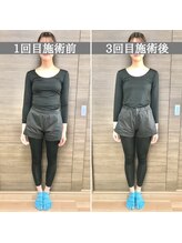 シェア 人形町店(Chare)/【小顔・骨盤矯正・О脚・整体】