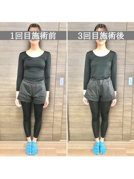 シェア 人形町店(Chare)/【小顔・骨盤矯正・О脚・整体】