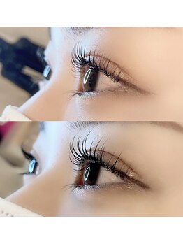 シャルム(Charme)/ラッシュアディクト