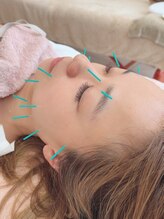 ヒーリングサロン アージュ(A-je)/★美顔鍼＋小顔矯正★