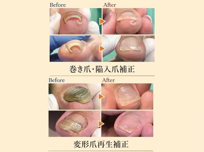 巻き爪補正店 北千住店の写真