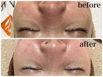 フェイシャルサロン アリイ(ALII)/