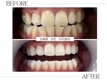 ホワイトニングサロンブライト 尼崎店(Whitening salon bright)/セルフホワイトニング　女性