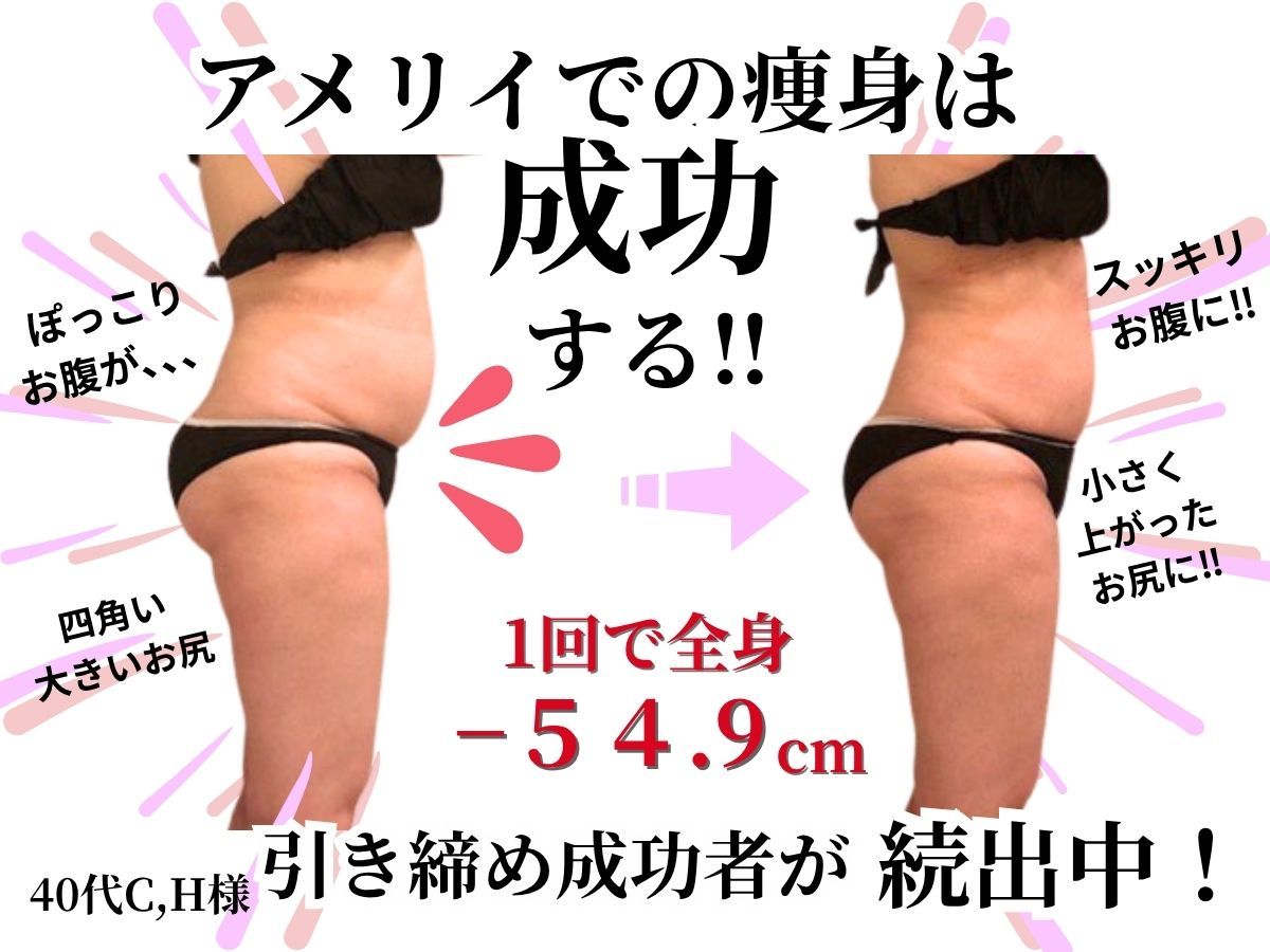 新百合ヶ丘駅でダイエットが人気のエステサロン｜ホットペッパー