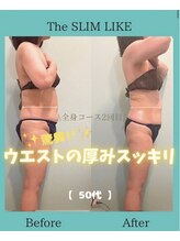 スリムライク 鳥取店(The SLIM LIKE)/痩身ビフォーアフター