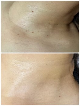 サロンドティアラ(Salon de Tiara)/イボケア