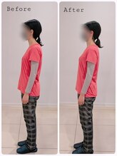 ヒダマリ(HIDAMARI)/猫背矯正ビフォーアフター！