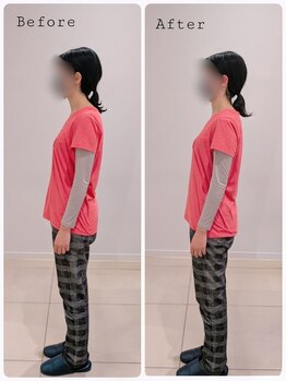 ヒダマリ(HIDAMARI)/猫背矯正ビフォーアフター！