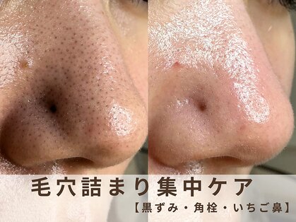 スイ(Suui.)の写真