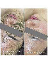 ヴィオナス(Veonus)/エステ初めて受けました