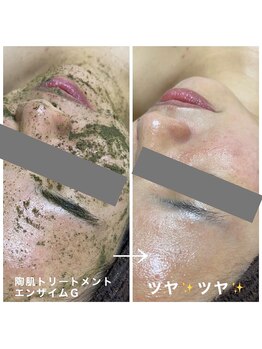 ヴィオナス(Veonus)/エステ初めて受けました