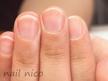 ネイルニコ(nail nico)/スペシャルネイルケア