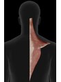 ボディプラス ボディリセット 肩こりの時、僧帽筋はいかり肩では短縮、なで肩では伸びている